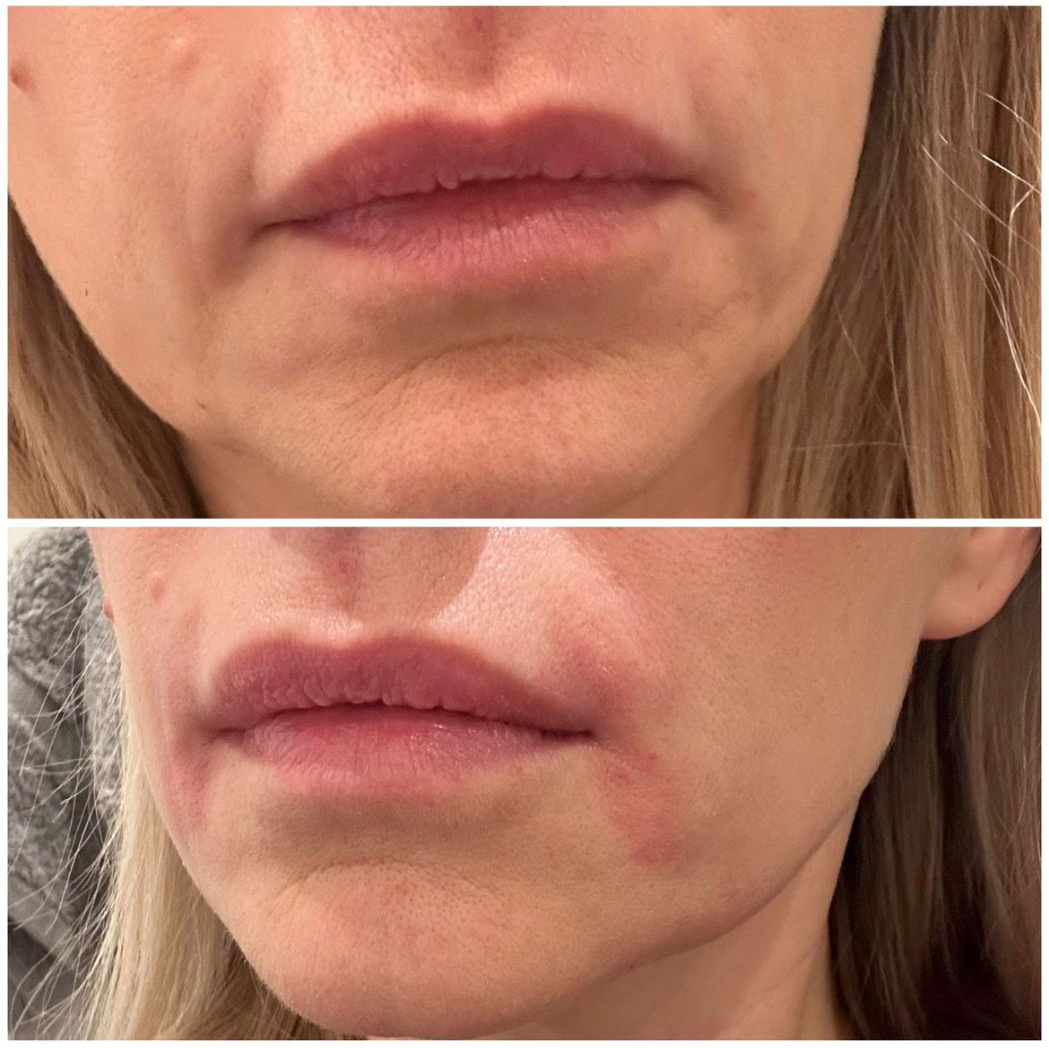 Golden Glow Aesthetics treatment